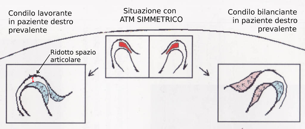 Condilo e situazioni reali
